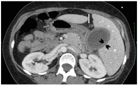 Imaging Anatomy and Pathology Assignment8.png